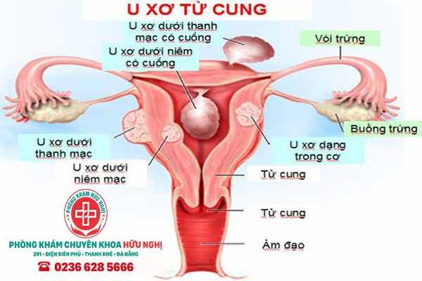 u-xo-tu-cung