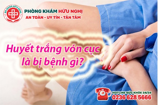 Huyết trắng vón cục là bị bệnh gì?